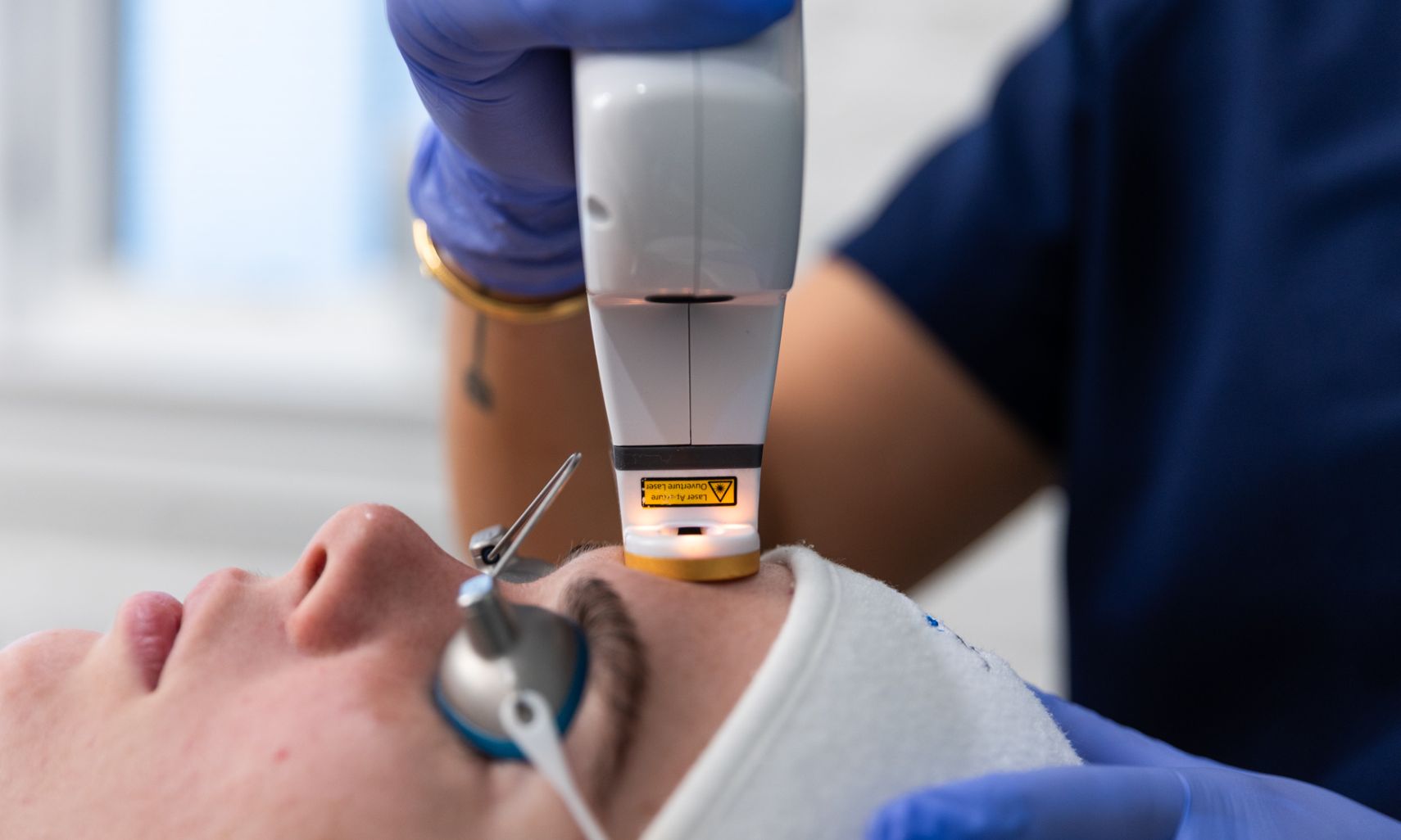 Client receiving AviClear laser treatment