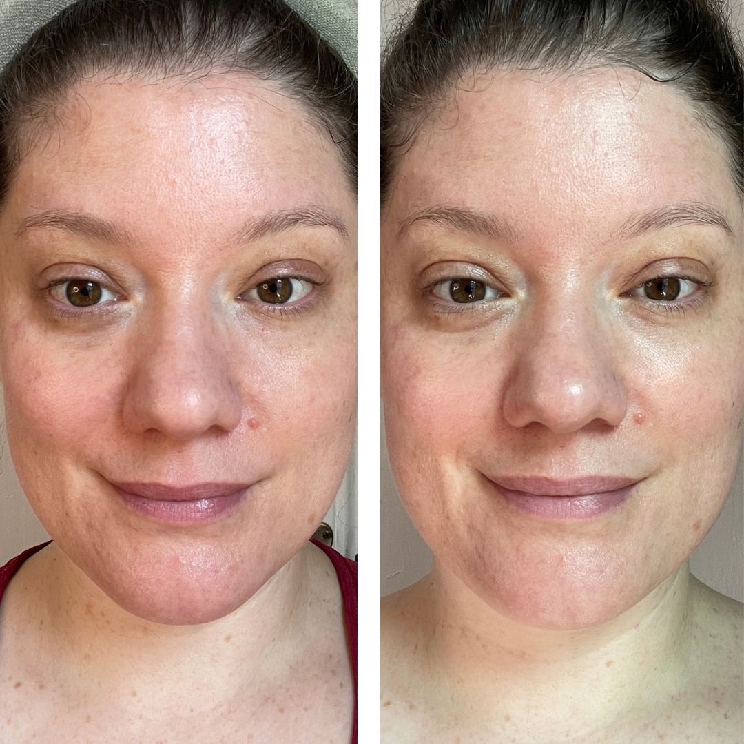 Side-by-side comparison portraits showing Day 1 before treatment on the left and Day 5 of using Noble Panacea RetiNAD+ Renewal Booster on the right.