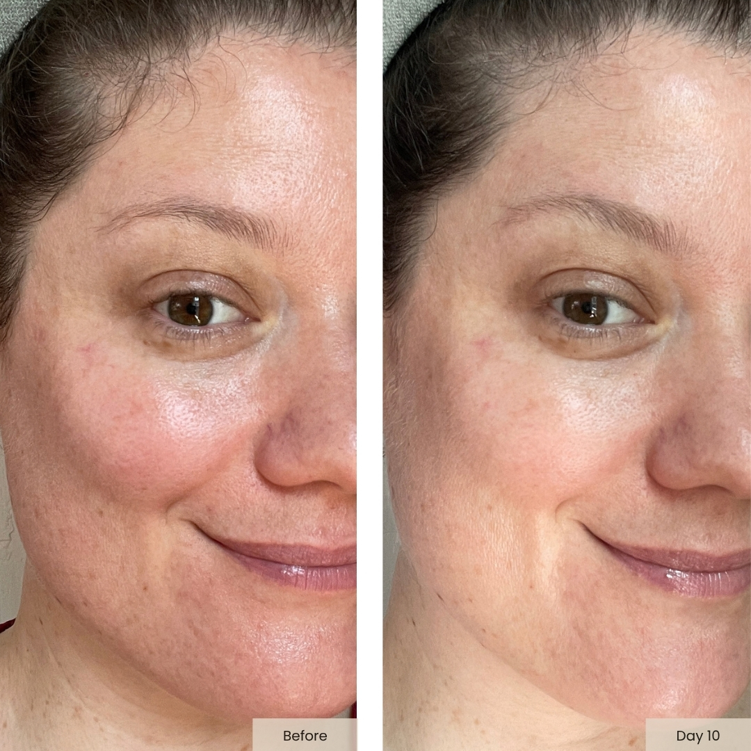 Side-by-side close-up comparison shots showing Day 1 before treatment on the left and Day 10 of using Noble Panacea RetiNAD+ Renewal Booster on the right.