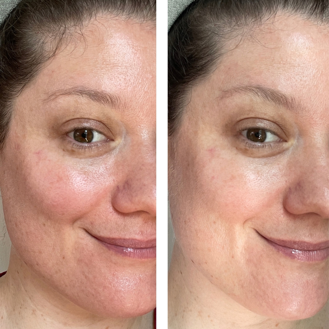 Side-by-side close-up comparison shots showing Day 1 before treatment on the left and Day 10 of using Noble Panacea RetiNAD+ Renewal Booster on the right.