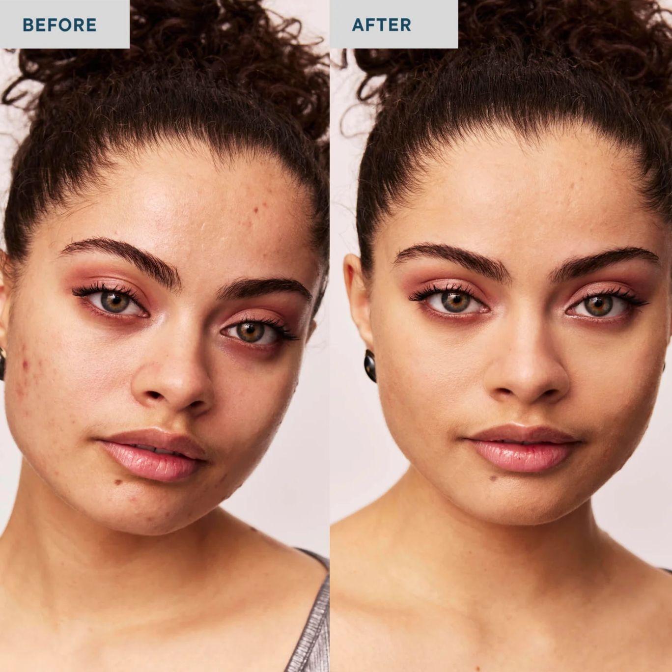 a before and after of model wearing Spatch Invisible Spot Fix